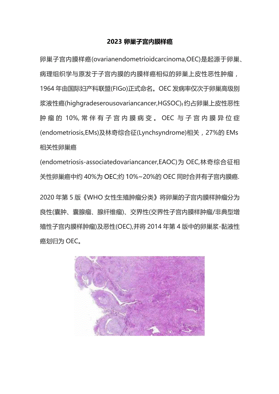 2023卵巢子宫内膜样癌.docx_第1页