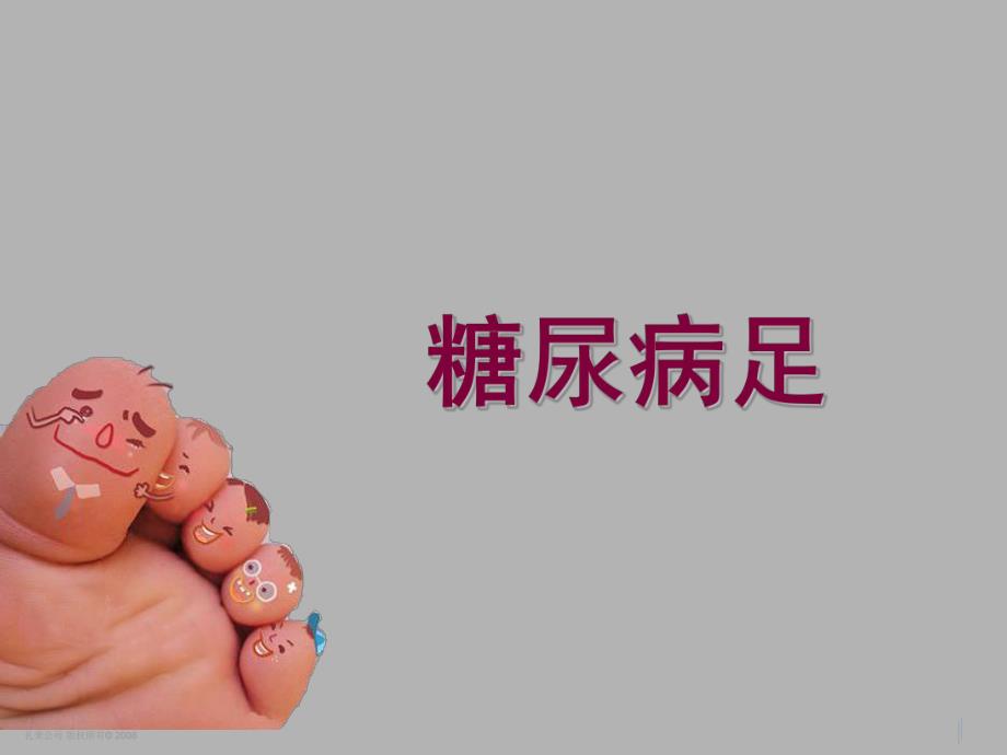 糖尿病足.ppt_第1页