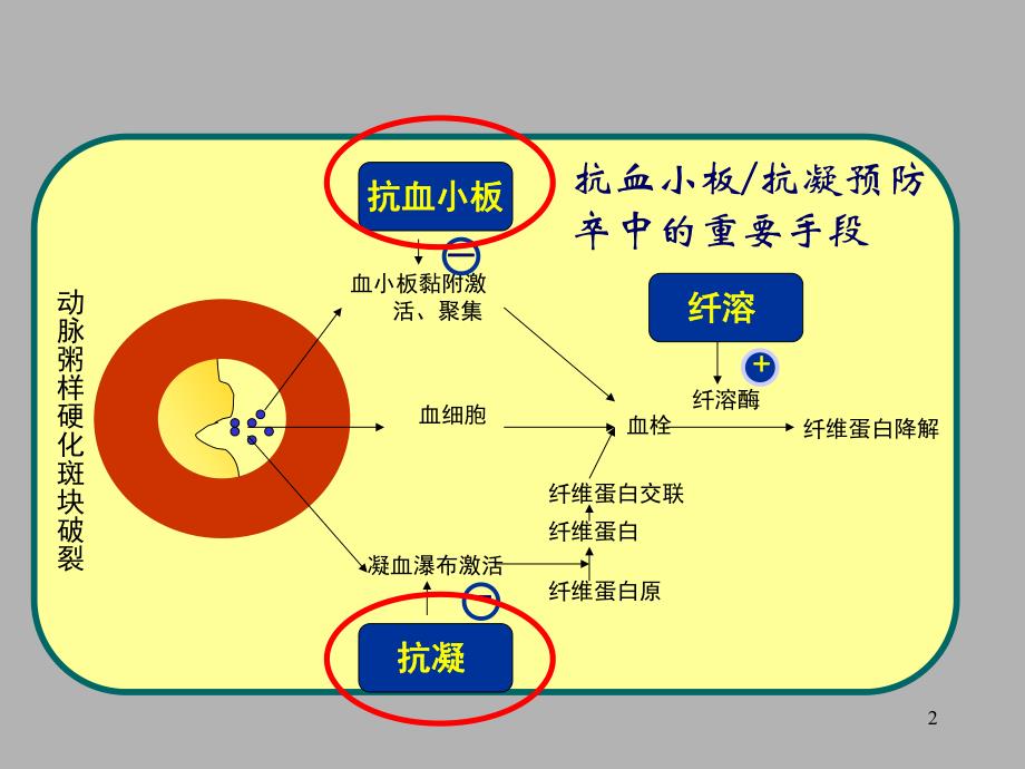 缺血性脑卒中／TIA 二级预防抗血小板药物规范化应用的中国专家共识.ppt_第2页