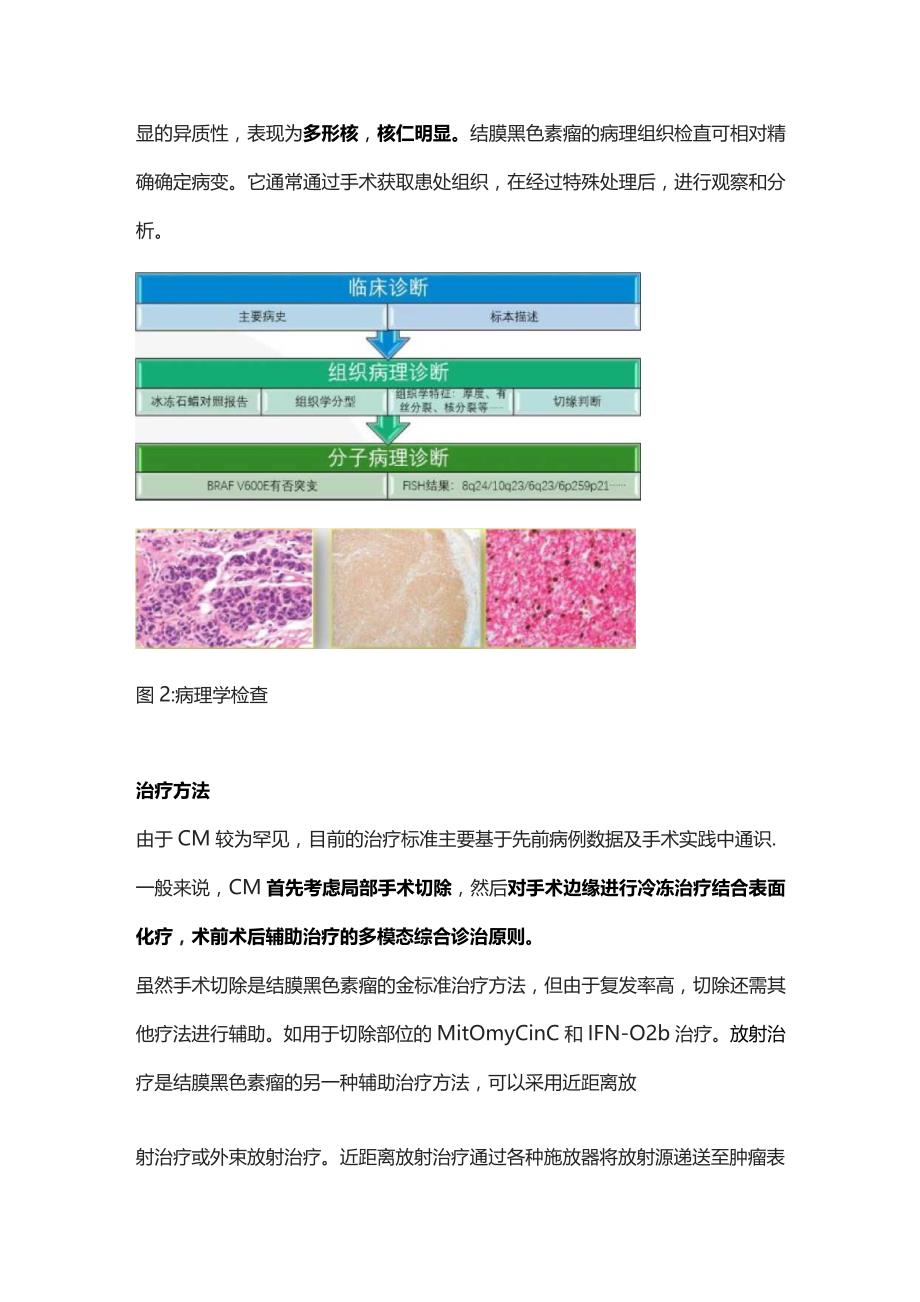 2023结膜黑色素瘤的鉴别诊断.docx_第3页