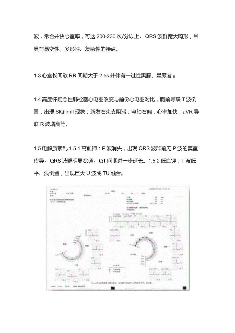 2023心电图危急值标准汇总.docx_第3页