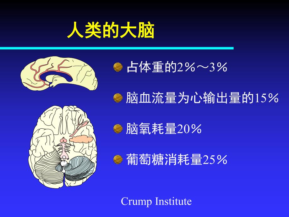 血管性痴呆.ppt_第3页