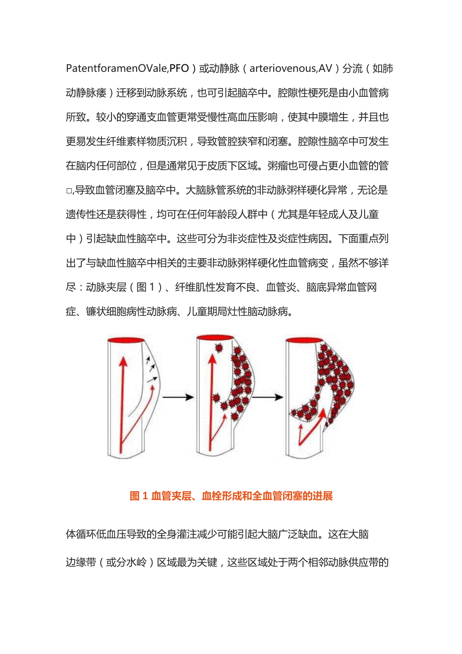 2023缺血性脑卒中的病理生理学.docx_第3页