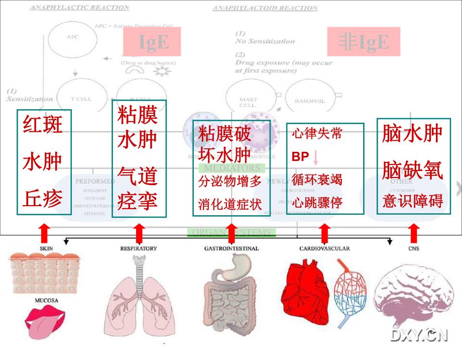 围术期过敏反应.ppt_第3页