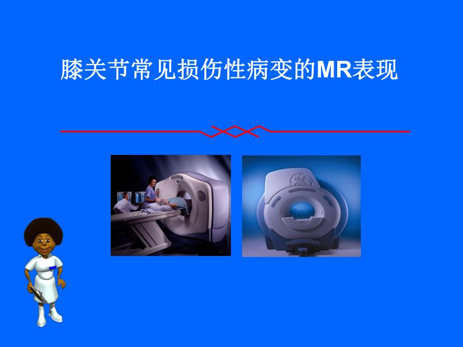 膝关节常见损伤性病变的MR表现.ppt_第1页