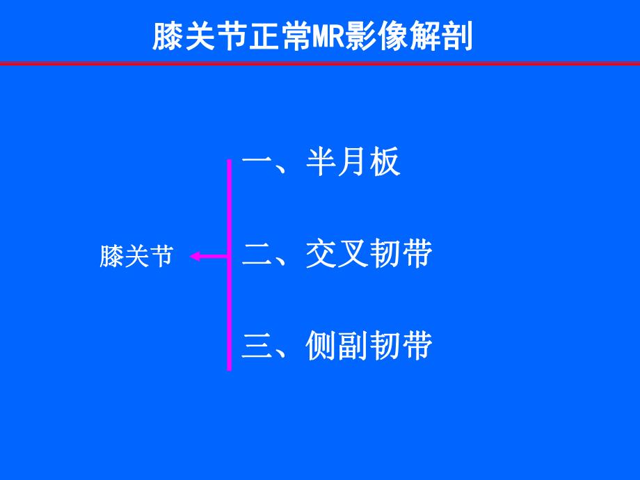 膝关节常见损伤性病变的MR表现.ppt_第3页