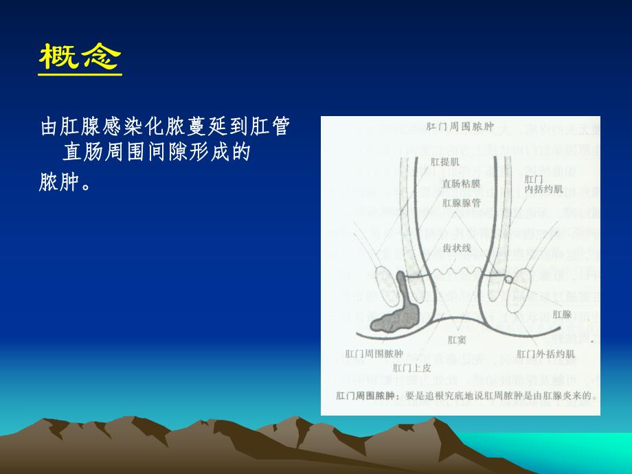 肛门直肠周围脓肿.ppt_第2页