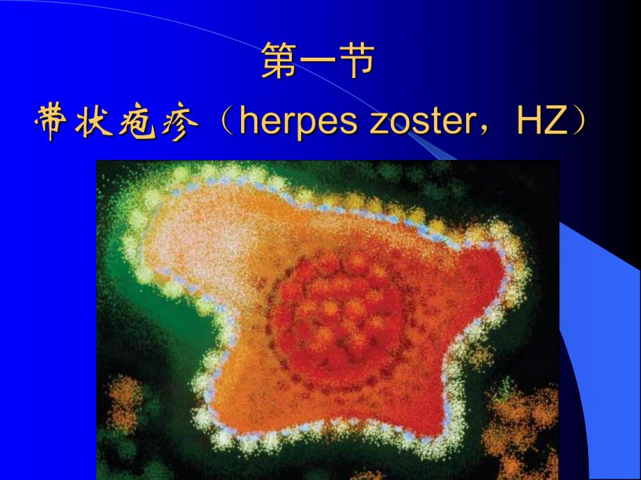 带状疱疹的诊断治疗进展PPT,!.ppt_第2页