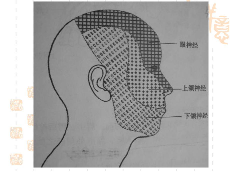 医学资料第十一章颌面部神经疾患.ppt_第3页