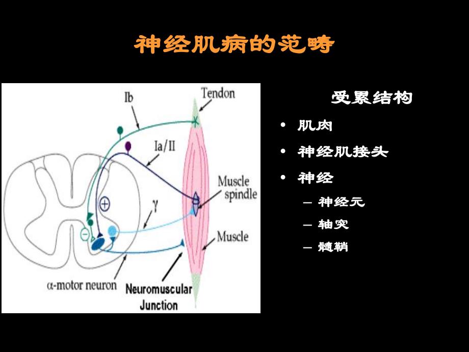 神经肌病概述.ppt_第2页