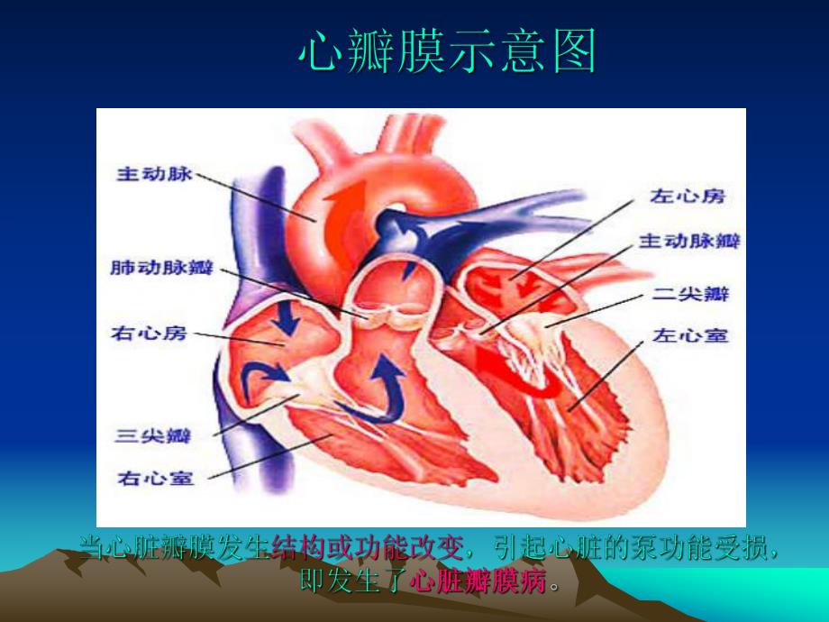 二尖瓣膜狭窄与换瓣治疗.ppt_第2页