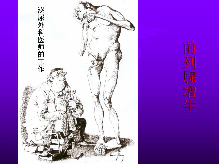 前列腺增生.ppt_第1页