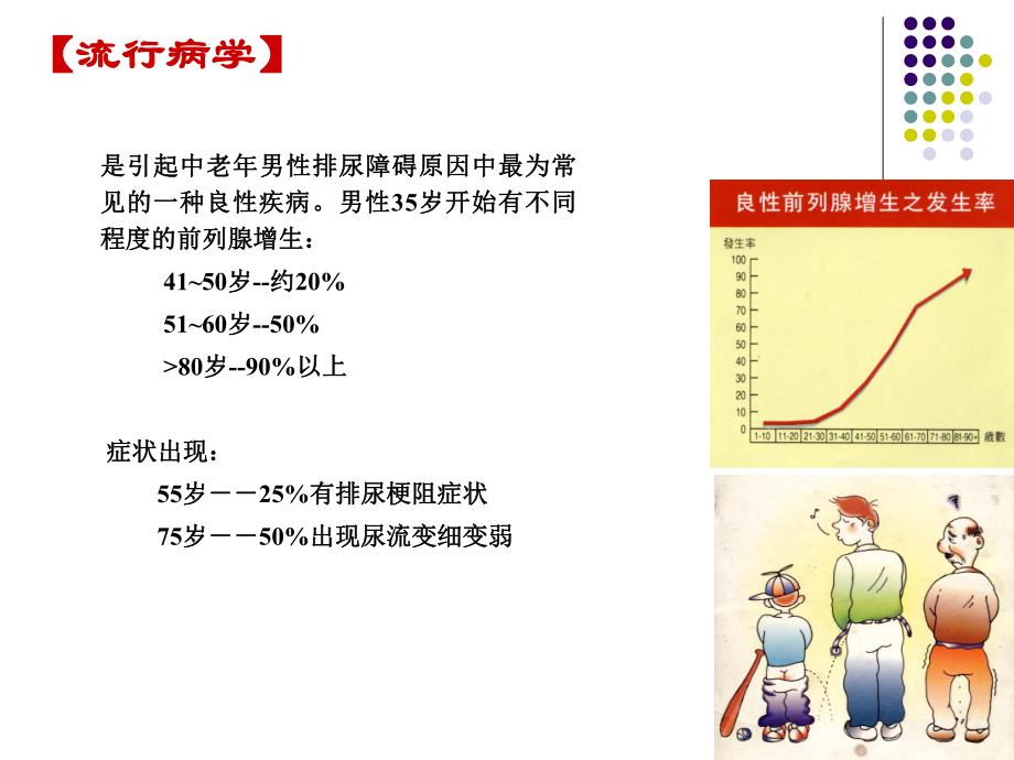 前列腺增生.ppt_第2页