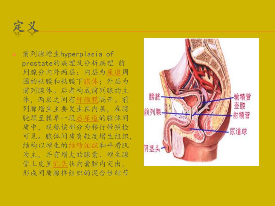 前列腺增生.ppt.ppt_第3页