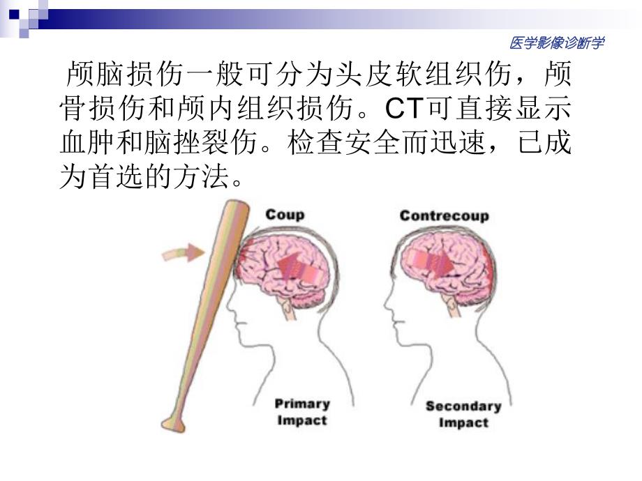 颅脑损伤的影像诊断.ppt_第2页