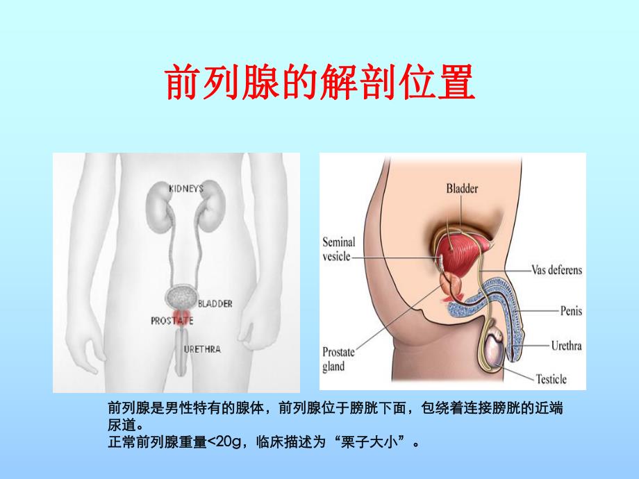 前列腺增生.ppt_第3页