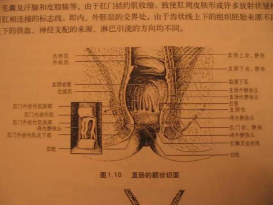 医疗知识培训你医院外科培训肛管职场疾病知识培训.ppt_第3页