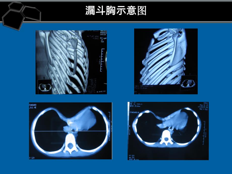 医院手术常见并发症处理及预防1.ppt_第2页