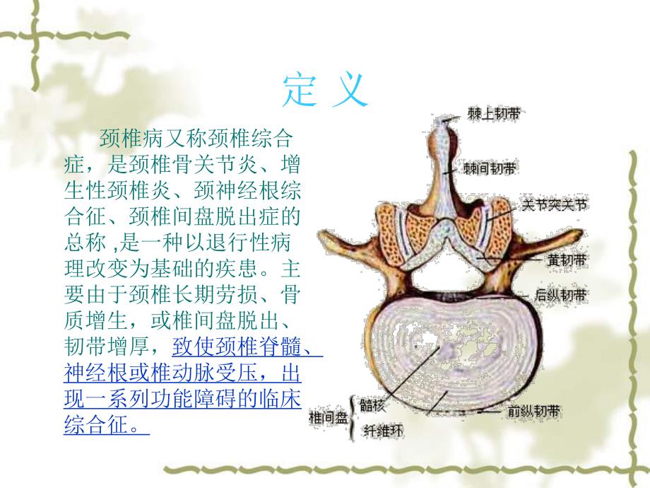 颈椎病的X线征象与临床.ppt_第2页