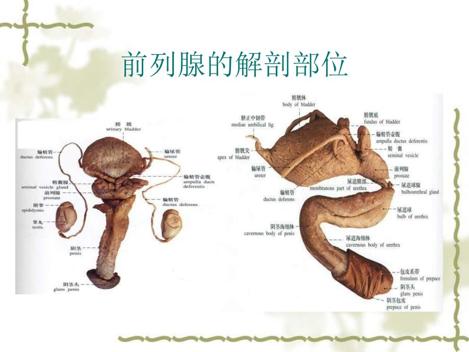 前列腺增生症.ppt_第3页