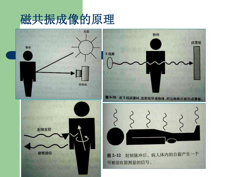 1.5T磁共振的临床应用.ppt_第3页