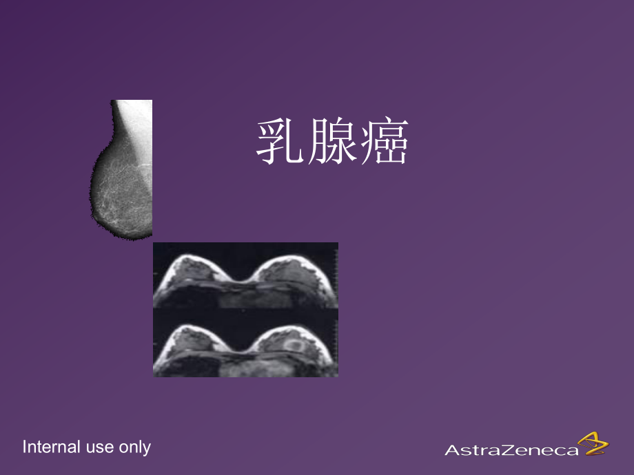 2-乳腺癌基础知识.ppt_第1页