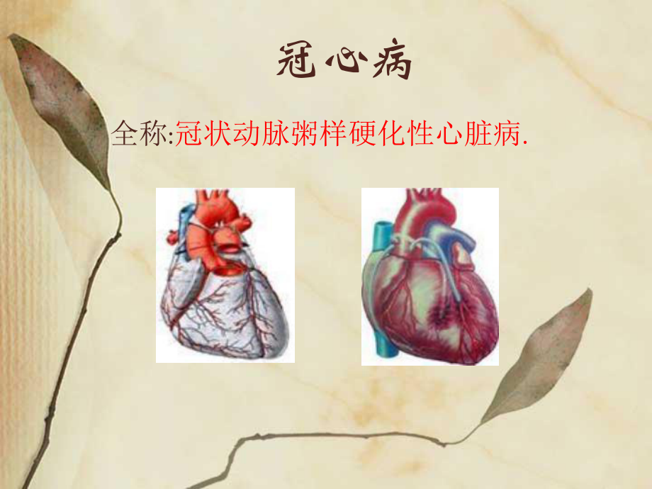 冠心病知识讲座.ppt_第2页