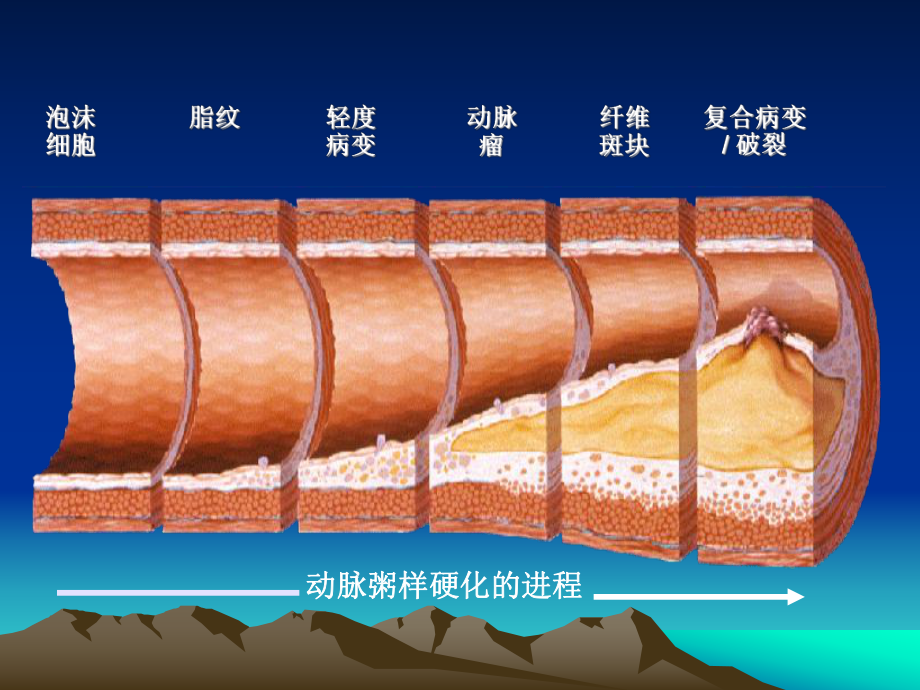 冠心病诊断与治疗指南.ppt_第3页