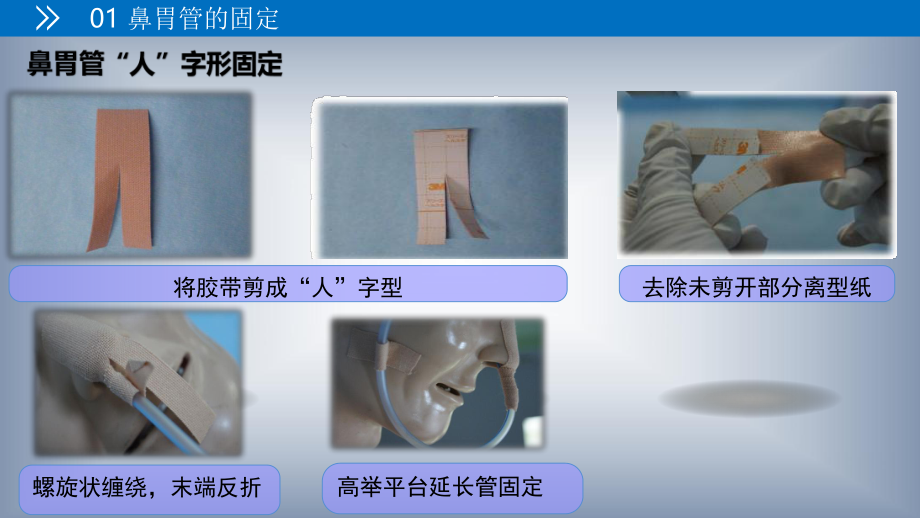 各种常见留置管道的固定方法及注意事项.ppt_第3页