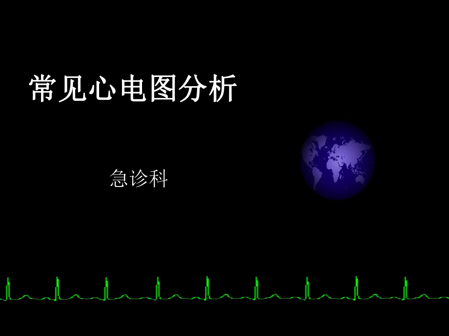 常见心电图分析.ppt_第1页