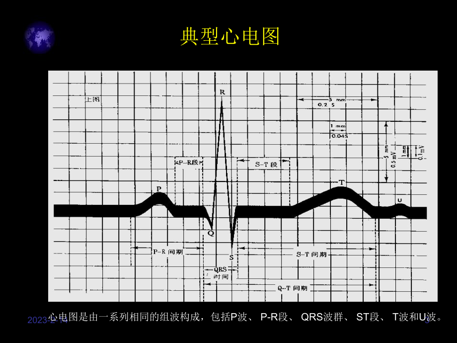 常见心电图分析.ppt_第3页