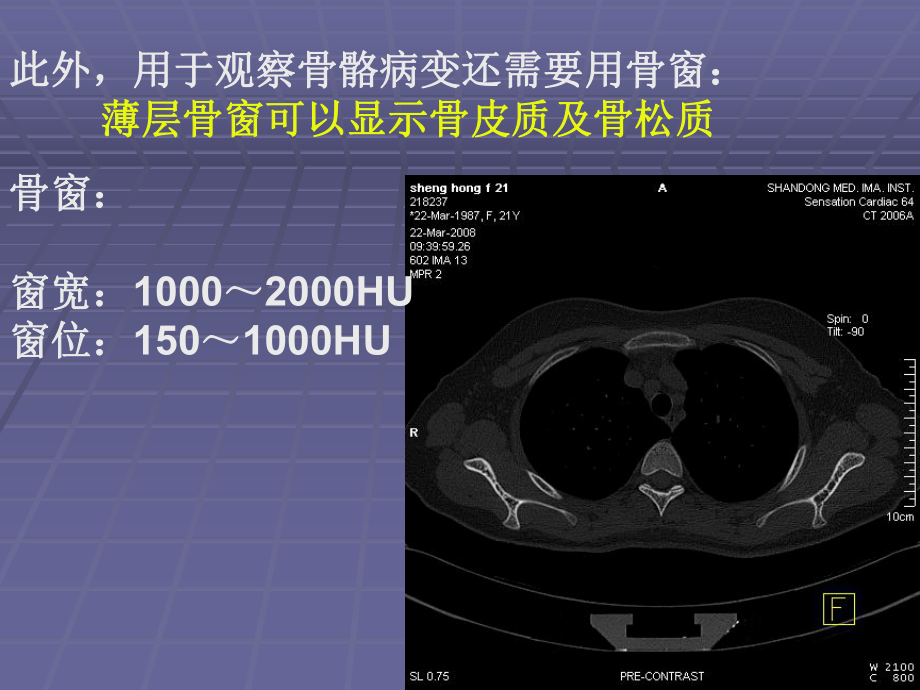 正常胸肺部CT影像学.ppt_第3页