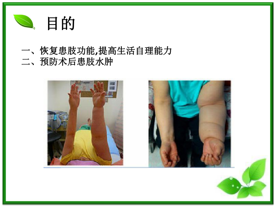 乳腺癌功能锻炼.ppt_第2页