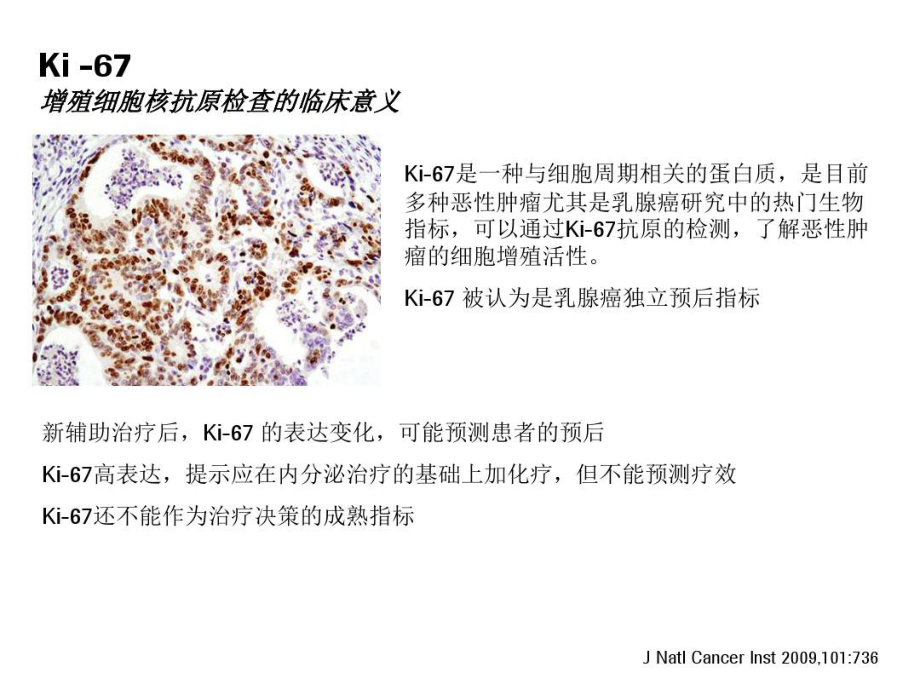 乳腺癌分子分型.ppt_第3页