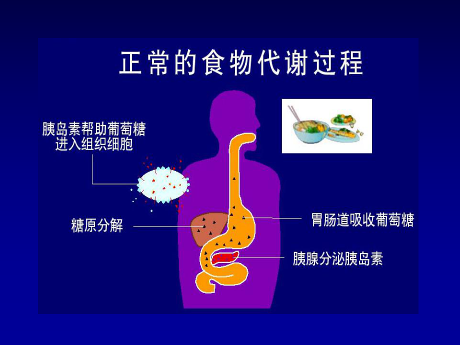 糖尿病饮食管理.ppt_第2页