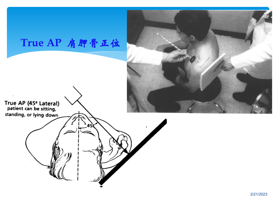 肩关节影像学及特殊检查.ppt_第3页