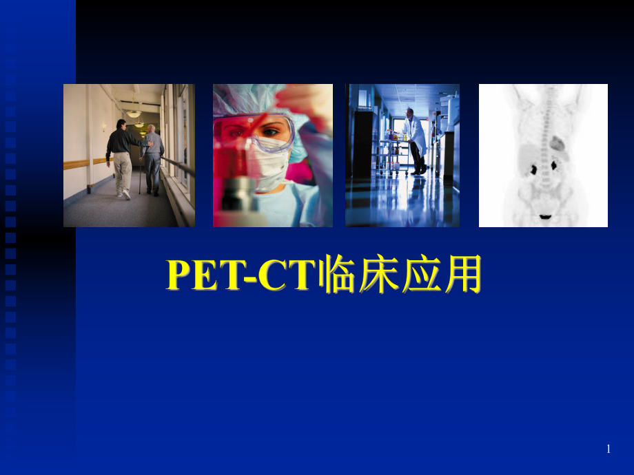 脑部PET的临床应用.ppt_第1页