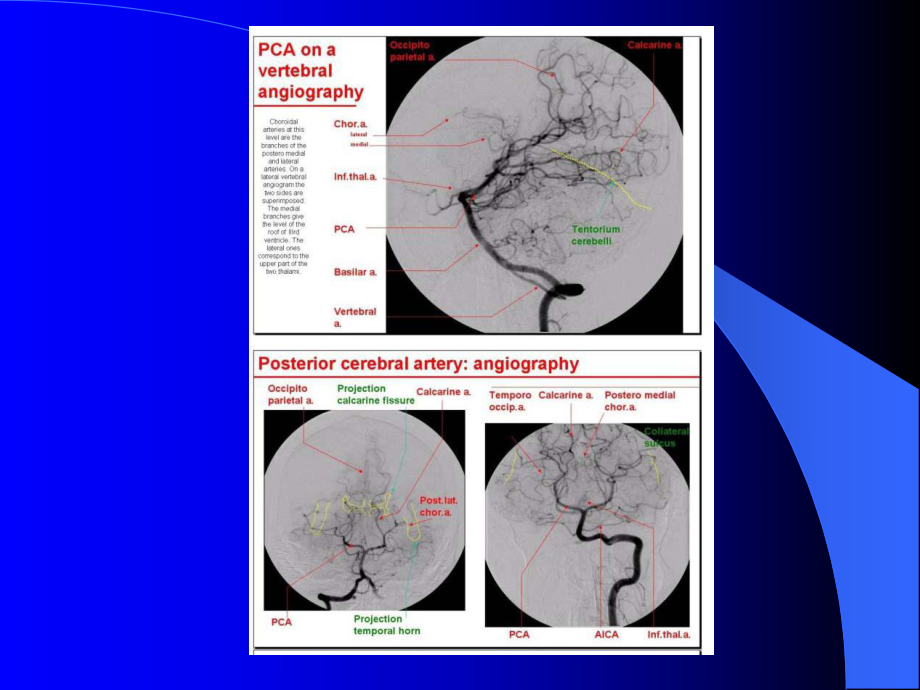 脑血管解剖与影像学2.ppt_第1页