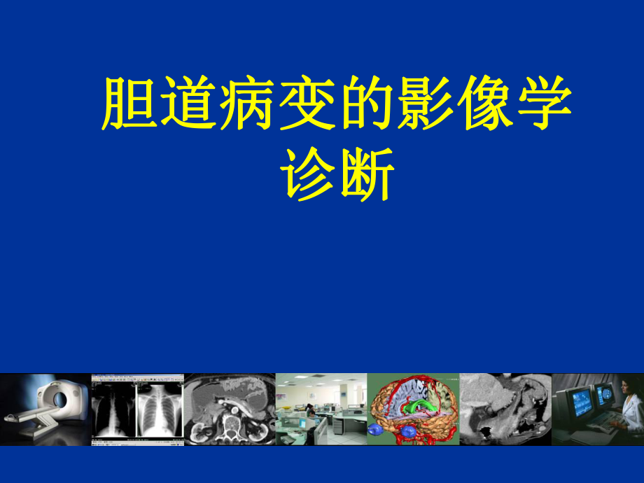 胆道疾病的影像学诊断素材.ppt_第1页