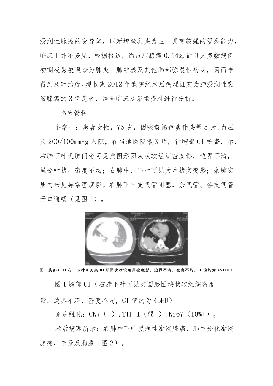 呼吸内科晋升副主任医师专题报告(肺浸润性黏液腺癌CT诊断分析).docx_第2页