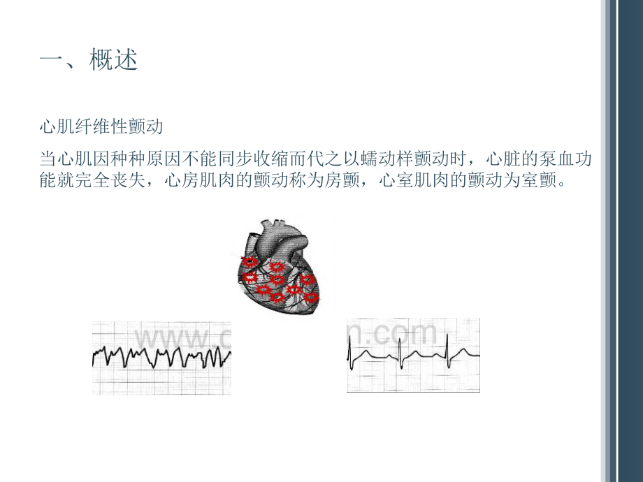 除颤仪的原理及质量控制.ppt_第1页