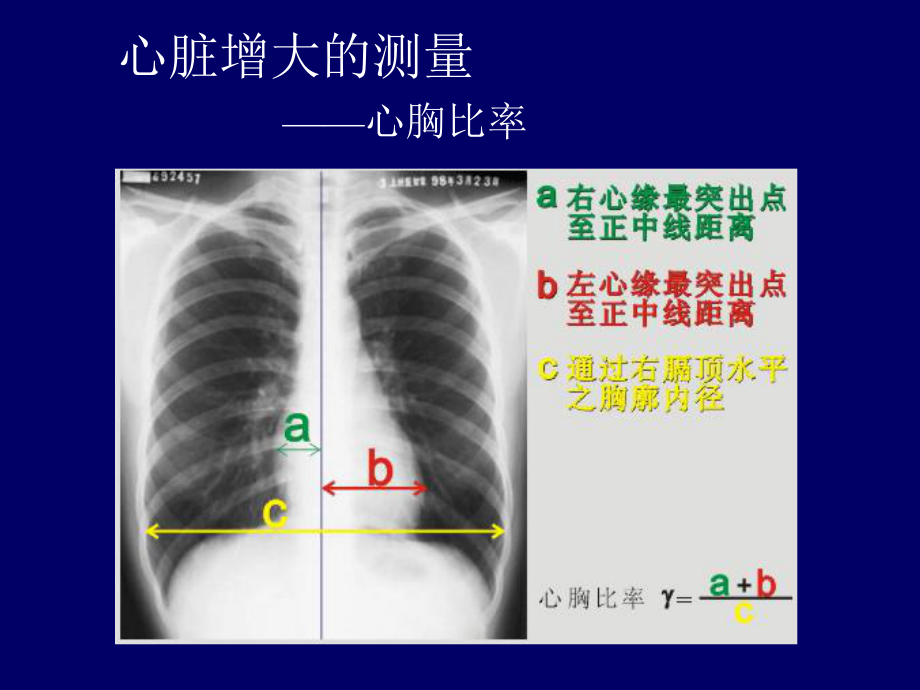 心血管疾病影像学诊断.ppt_第2页