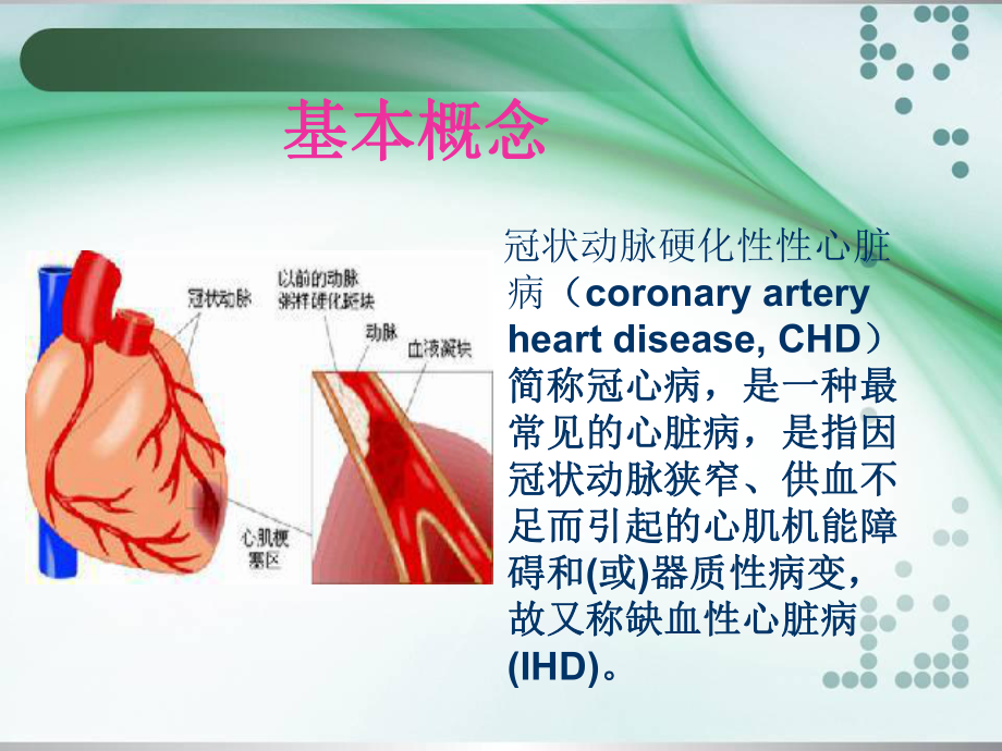 冠心病护理查房.ppt_第3页