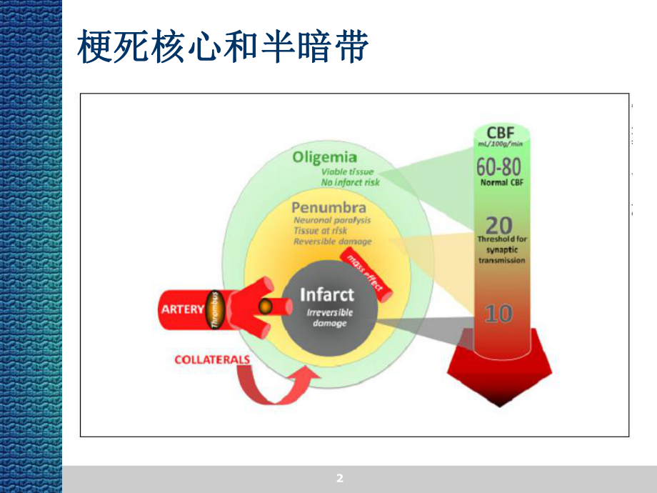 急性缺血性卒中的灌注影像学.ppt_第2页