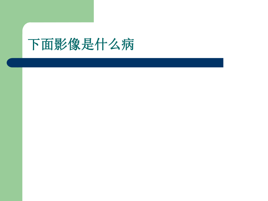 肺动脉栓塞影像学.ppt_第3页