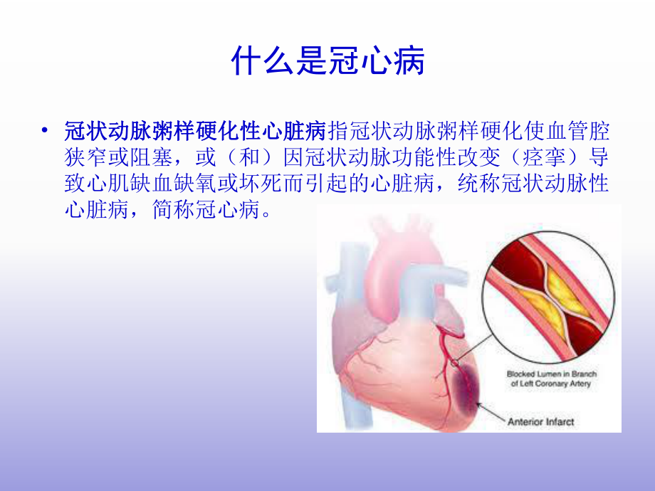 冠心病的健康宣教.ppt_第2页