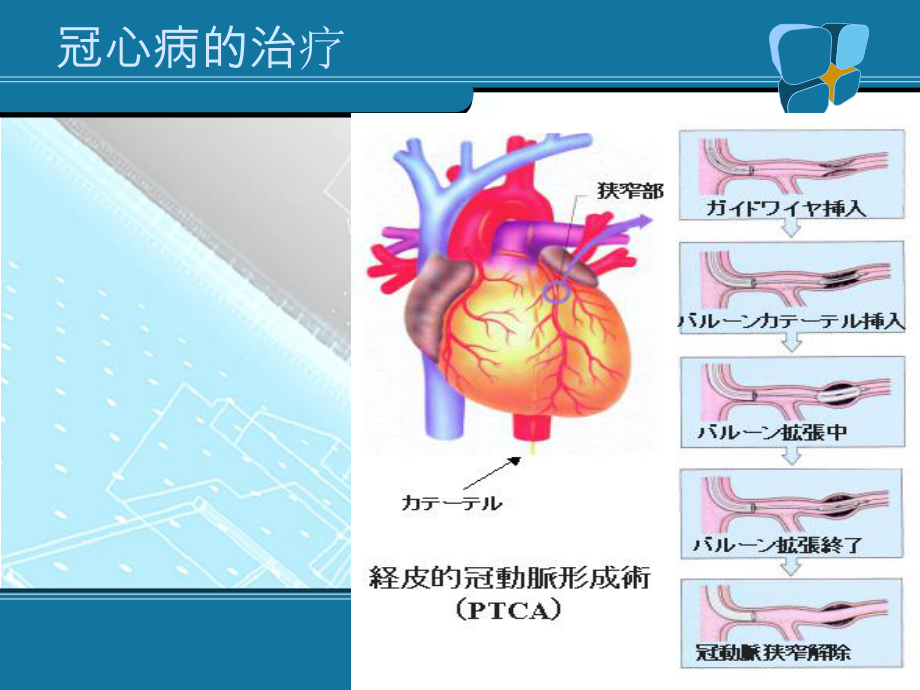 冠心病的康复治疗.ppt_第3页