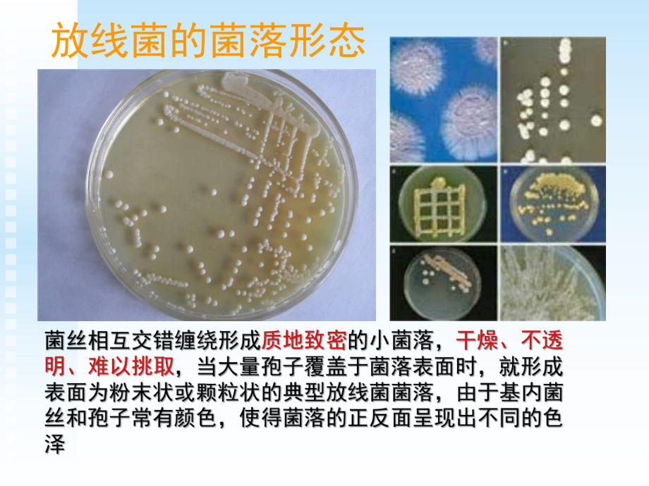 10其他微生物.ppt_第3页