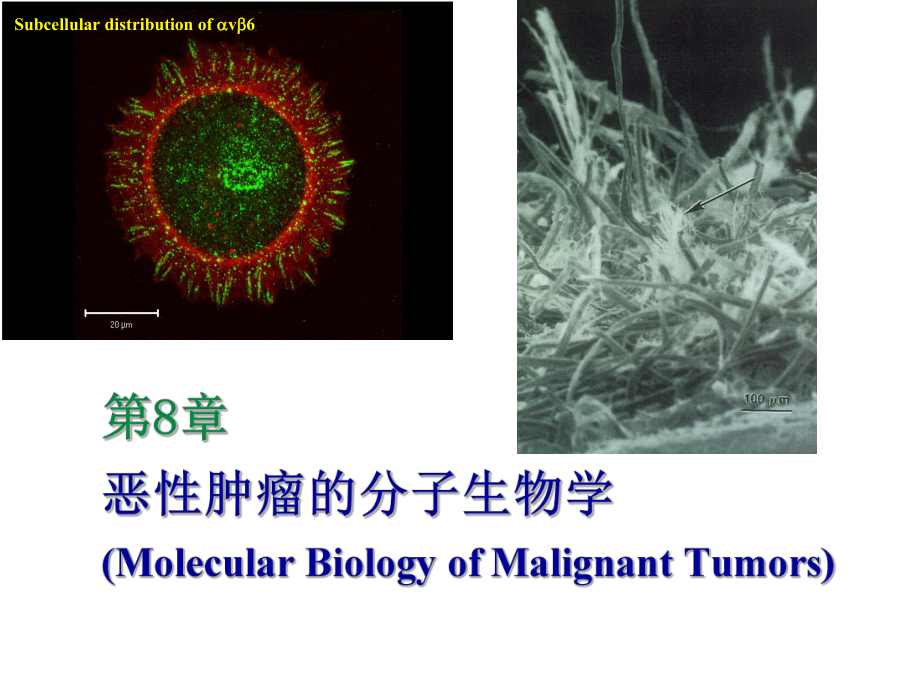 恶性肿瘤的分子生物学.ppt_第1页