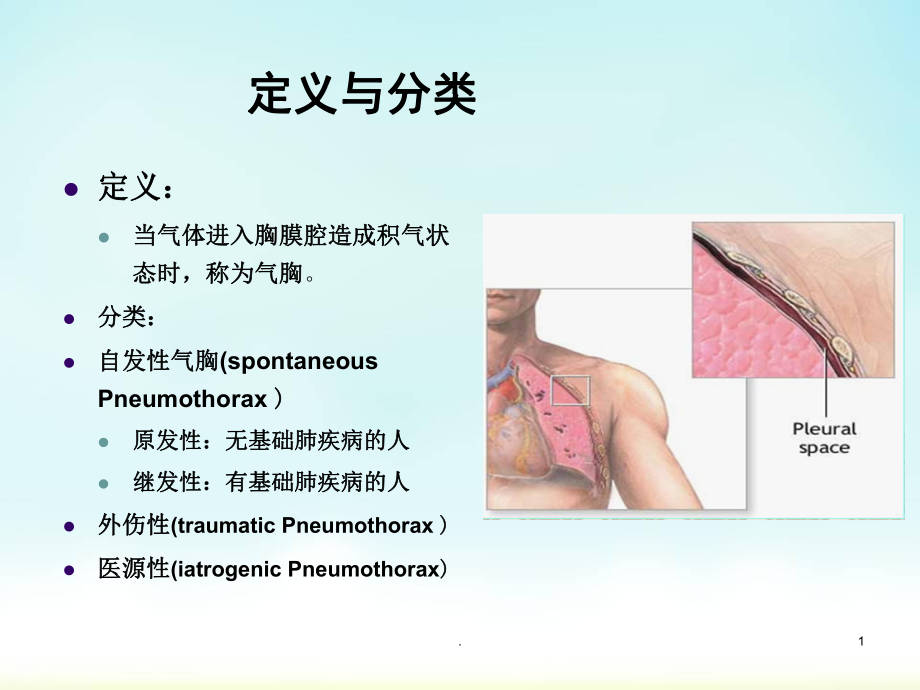 气胸医学PPT课件.ppt_第1页